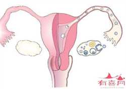 三亚代孕服务：孕晚期产检，有3个问题即使医生