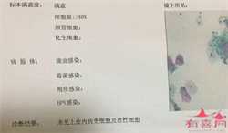 广东代孕QQ群：杭州看妇科去哪家医院比较好，什