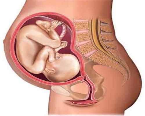 代孕期间如何预防胎儿畸形有4点你该知道尤其是