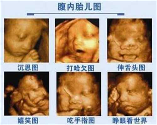 代孕过安检会影响胎儿吗代孕照X线会致胎儿畸形