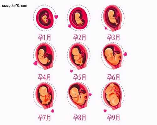 助孕注意：照CT可影响胎儿发育_常德有宝