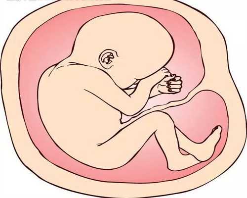 助孕妈：代孕几个月做四维彩超合适_97泰国网