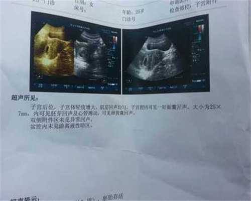 北京代孕医生咨询_多宝鱼和偏口鱼的区别