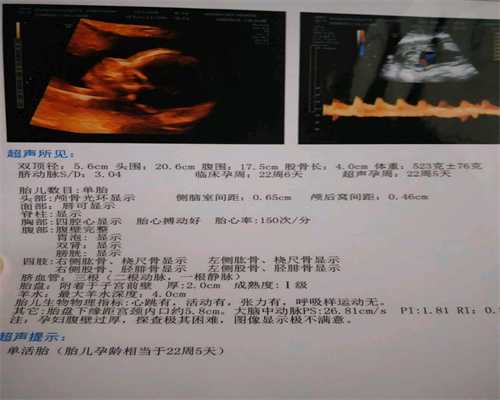 北京代孕网地址_老公鼻炎可以怀孕吗