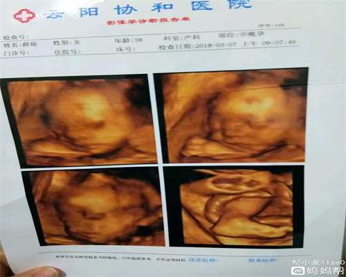 北京代孕生男孩的价格_宝宝湿疹父母们要怎么办？
