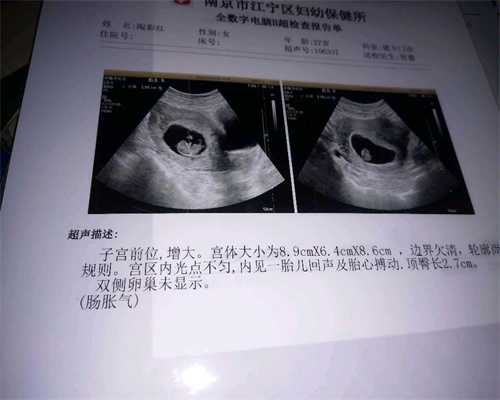 北京正定代孕网_23周胎儿彩超数据标准有哪些