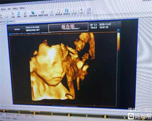 北京代孕风险有哪几项_怀孕多久可见孕黄囊