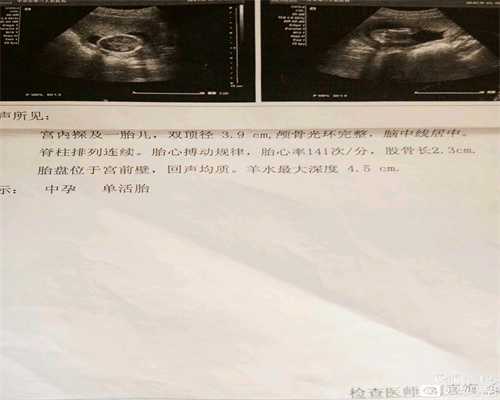 北京代孕生活服务网_糖尿病人怀孕注意什么