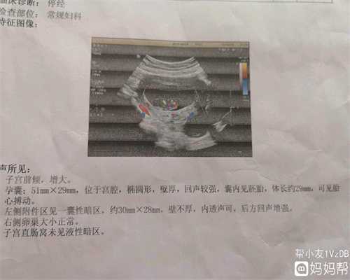 北京代孕公司 医院_怀孕后为啥总是失眠呢