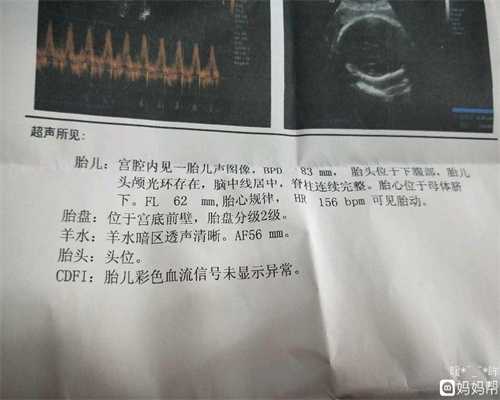 北京代孕总费用_哺乳期乳房乳头疼应该怎么办