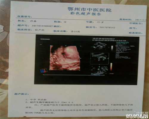 北京代孕检查项目_怀孕两个月的特征都有什么