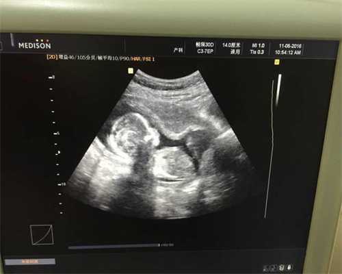 北京高龄代孕`想找个北京代孕机构`北京借卵子生子有哪些规定