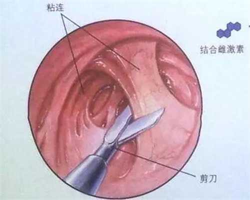 北京代孕协议,北京试管代孕的案例,怎么知道自己孕期血糖高