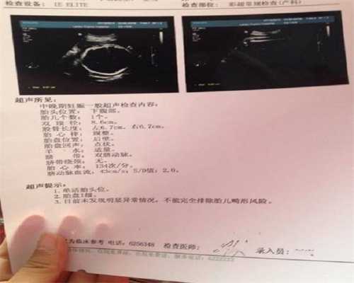 北京专业代孕`北京孕妈妈志愿者`胎儿哪些畸形是孕晚期出现的