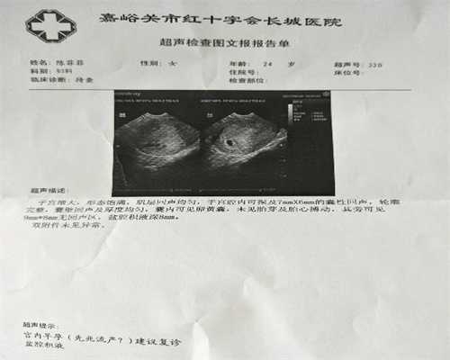 北京助孕供卵-贵州中药医院成功试管（北京大学医院试管的成功率）