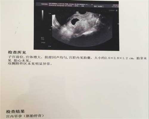 北京助孕供卵-北京157军用医院试管，济南军区综合院医院的试管多少钱？