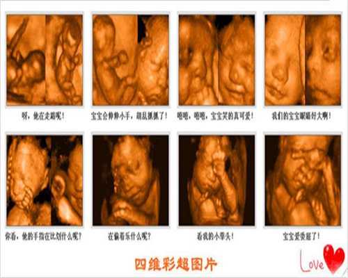 北京试管三代助孕-为什么你试图检查NK细胞？陕西省