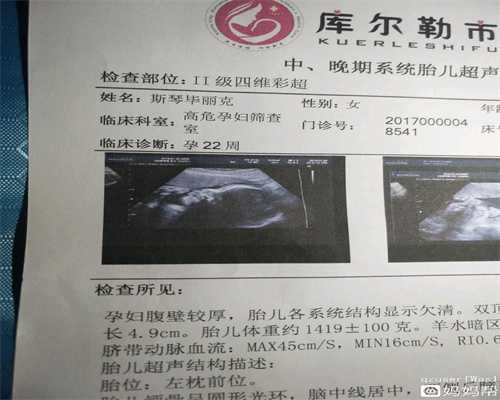 北京代孕好吗_代孕宝宝生殖_代孕小孩合法化