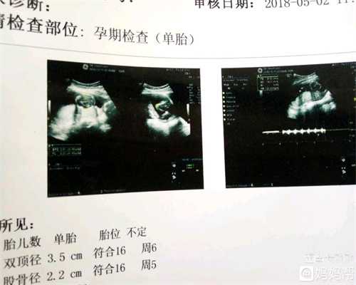 北京代孕生子费用_代孕孩子包成功_代孕孩子零风险包成功