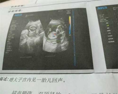 北京供卵知乎_北京做试管婴儿医院排名 怎么做试管婴儿