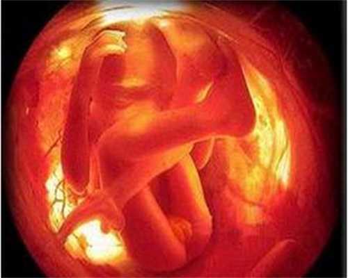 北京代孕包性别_北医三院（北京大学第三医院）试管婴儿具体流程是什么？ 