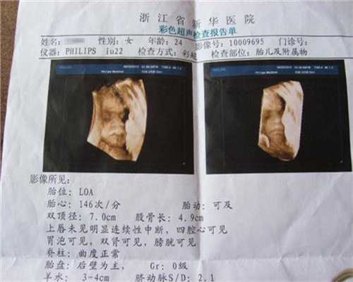 北京有人做代孕吗_2022年北京大学第三医院做试管婴儿费用多少？