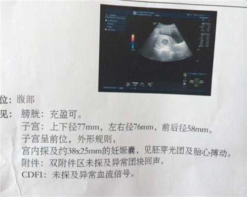 北京代孕妈妈-代孕生孩子价格多少_北京环保局称空气质量检测数据准确可靠