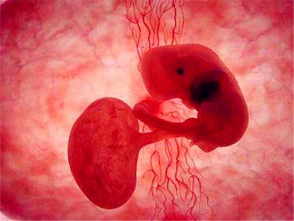 为什么海外做试管婴儿是冻胚移植呢？与鲜胚移植有什么区别？